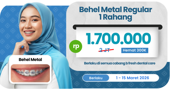 Behel Metal Regular